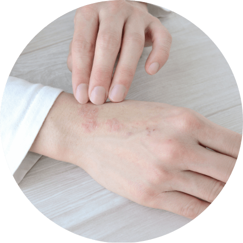 アレルギー疾患内科