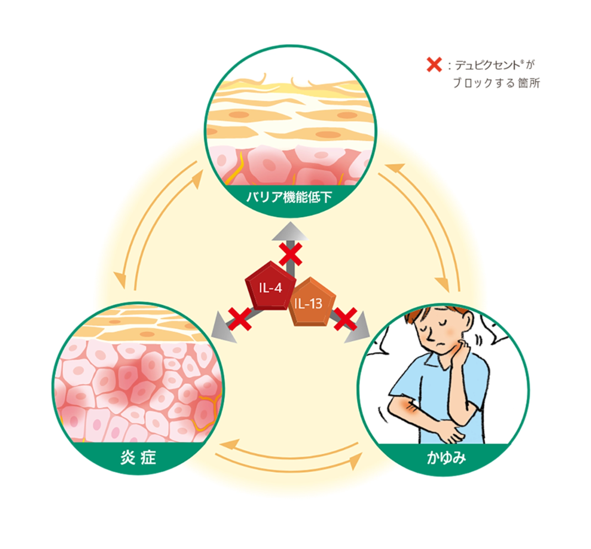 デュピクセントの作用機序